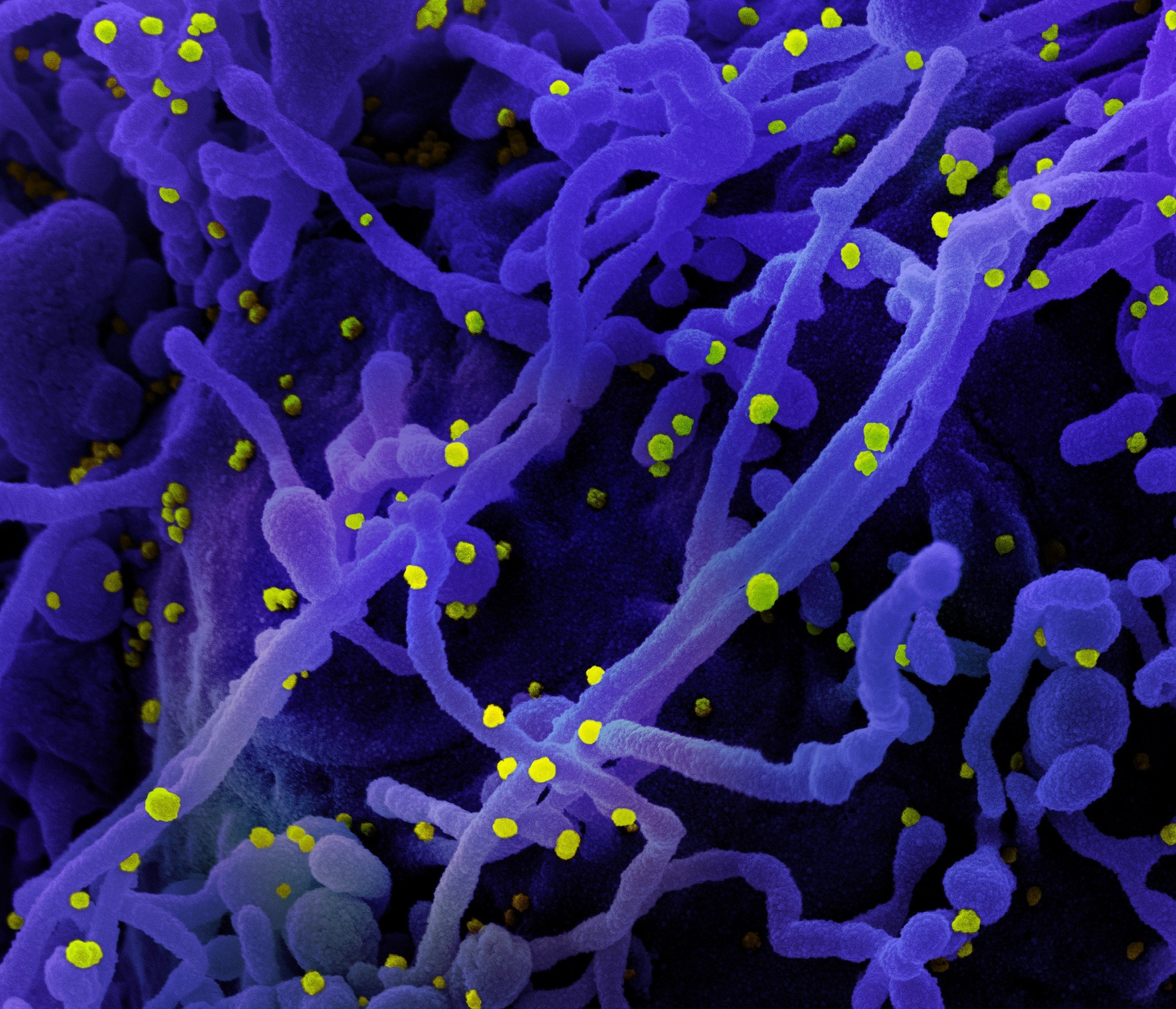 Ômicron é menos eficaz que a variante Delta no bloqueio de um mecanismo de defesa celular contra o coronavírus (Foto: NIAID)
