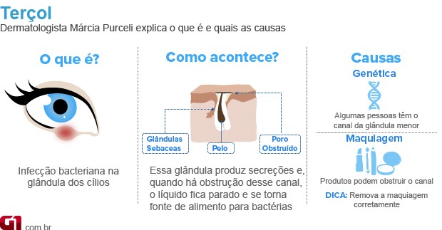 Pomada para terçol. Veja se você pode usar