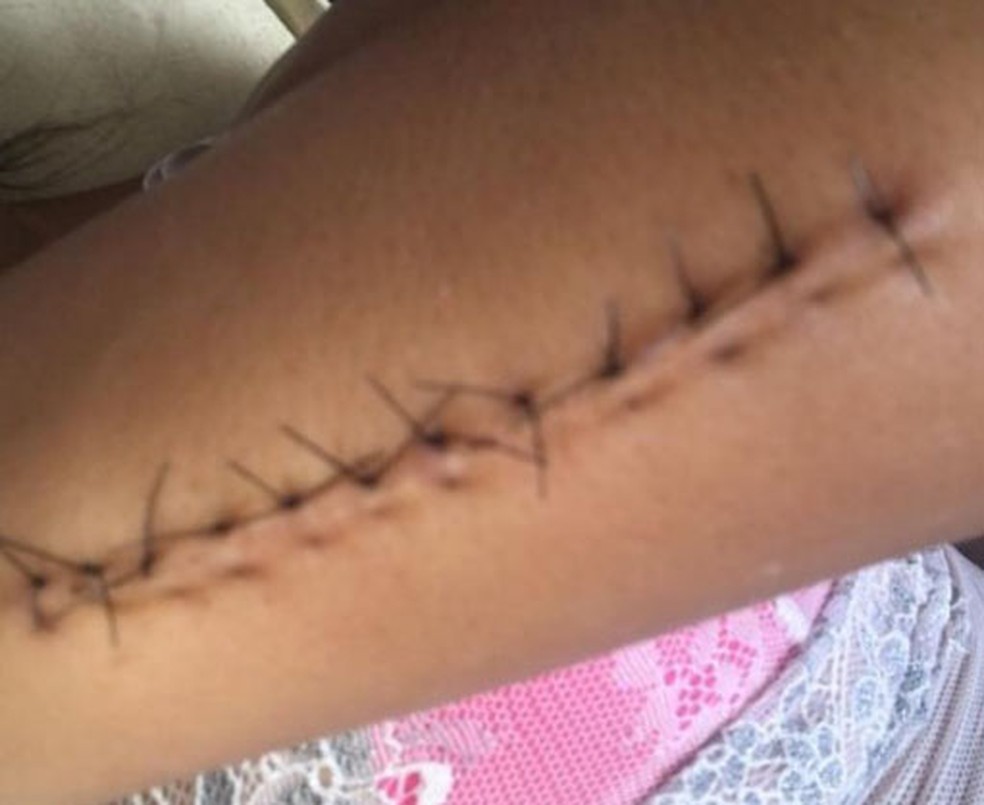 Marca de agressões anteriores — Foto: g1/Arquivo pessoal