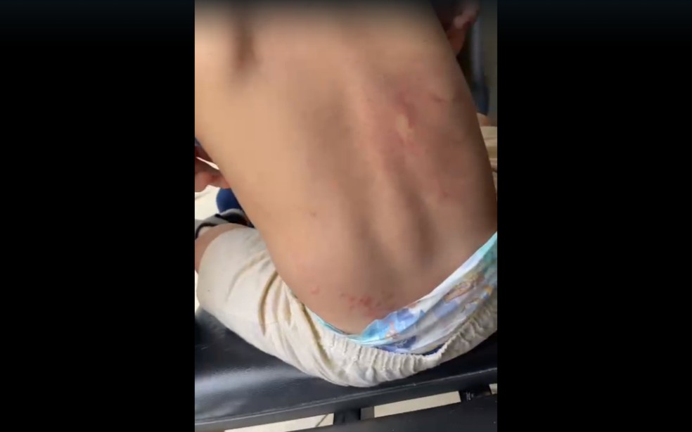 Mãe denuncia agressão a menino de três em Ilhéus — Foto: Arquivo pessoal