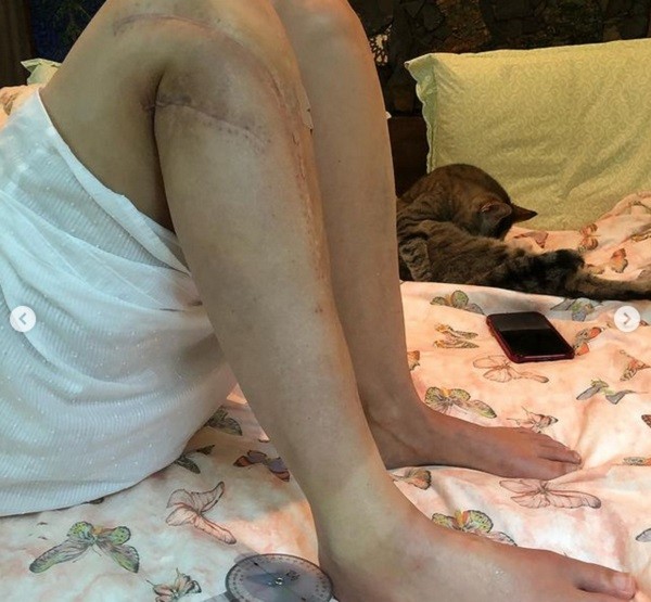 A astriz Ashley Judd e seu tratamento de recuperação (Foto: reprodução instagram)