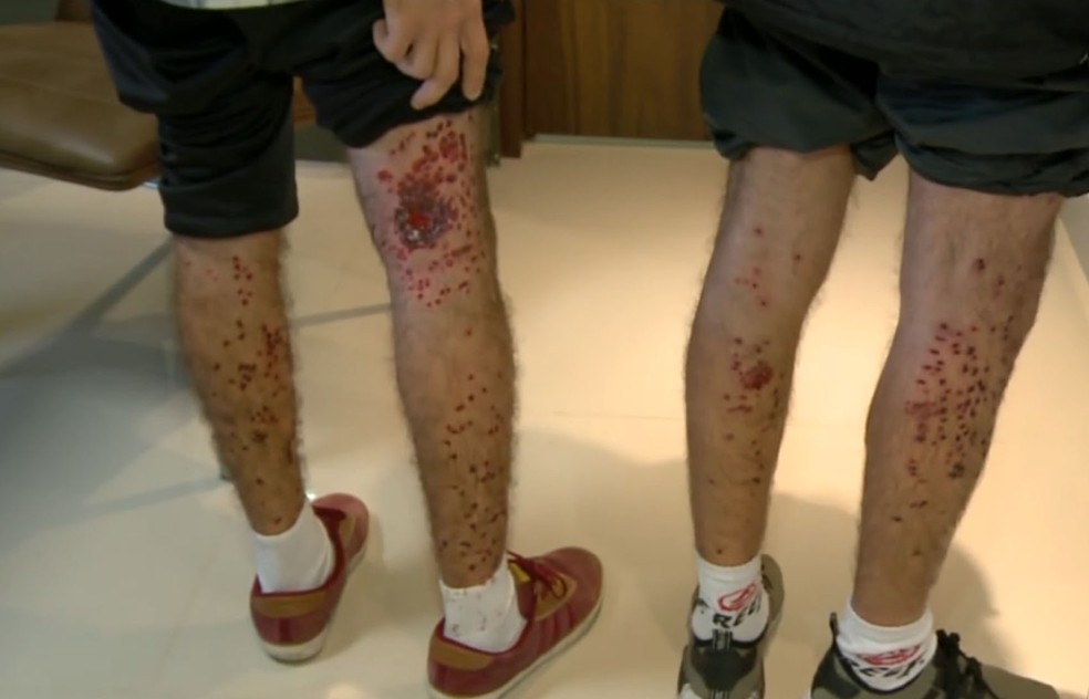 Pai e irmão de motociclista ficaram feridos por disparos de balas de borracha (Foto: Reprodução/RBS TV)