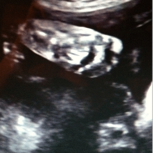 Alinne Moraes mostra o pé do seu primeiro filho em ultrassom (Foto: Reprodução/Instagram)