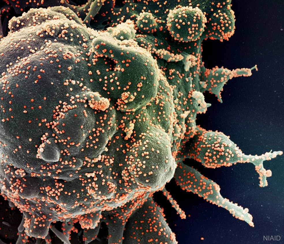 Foto microscópica mostra célula humana sendo infectada pelo Sars Cov-2, o novo coronavírus — Foto: NIAID via Nasa