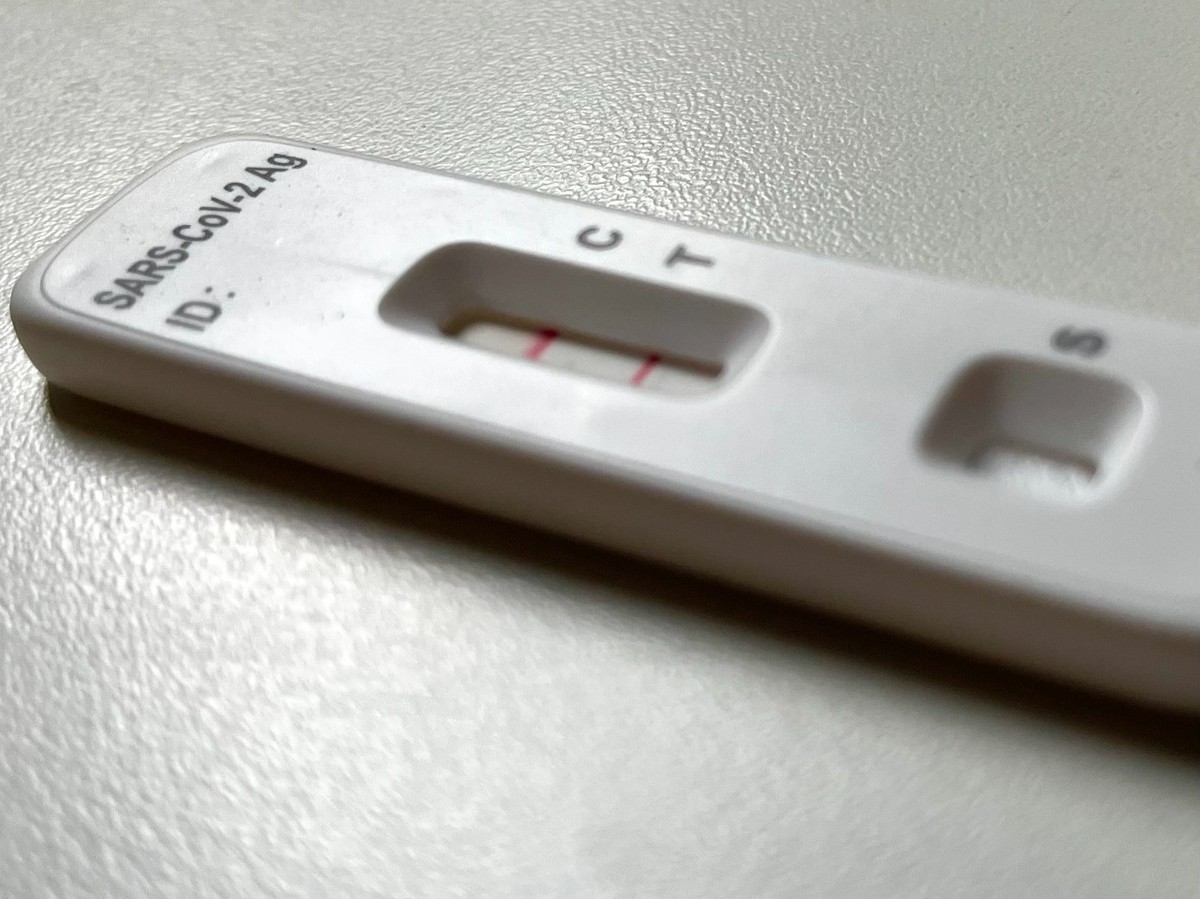 Covid-19: The Campinas region has seen an increase in deaths again, but cases are down 26% per week |  Campinas and region