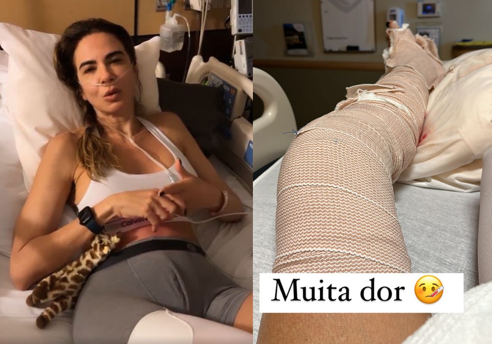 Luciana Gimenez grava vdeo aps acidente na neve  Foto: Reproduo/Instagram