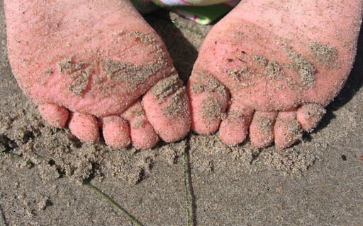 Apos Viajar Ao Brasil Menina De 10 Anos Sofre Com Infeccao Grave Nos Pes Revista Galileu Saude