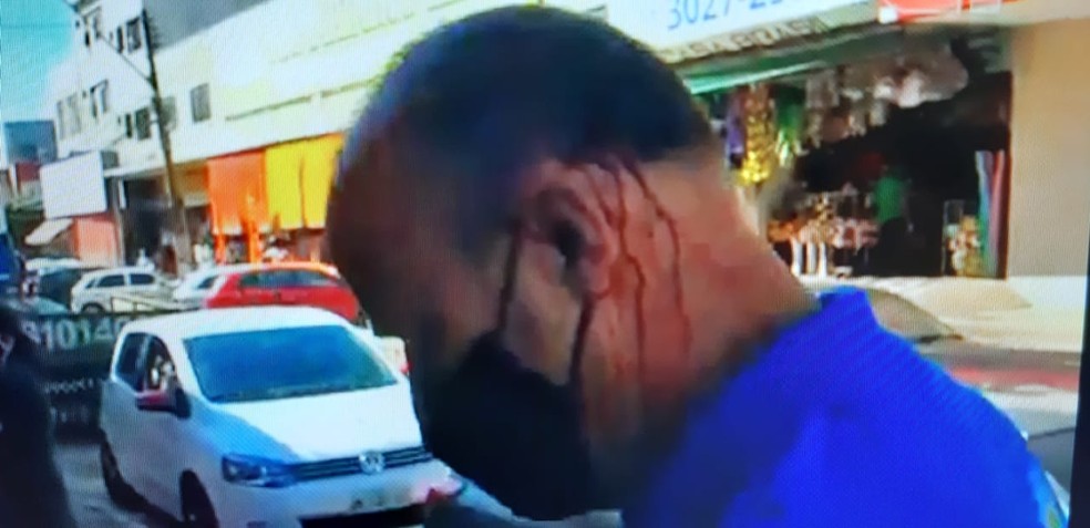 Fiscal do DF Legal foi agredido com cadeirada na cabela durante fiscalização, em Taguatinga — Foto: Arquivo pessoal