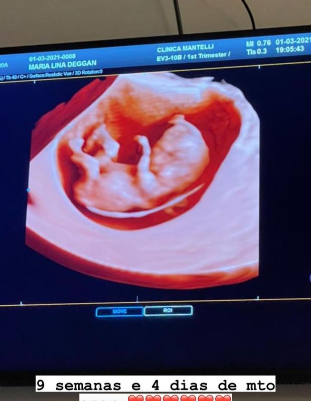 Maria Lina mostra ultrassom do filho (Foto: Reprodução/Instagram)