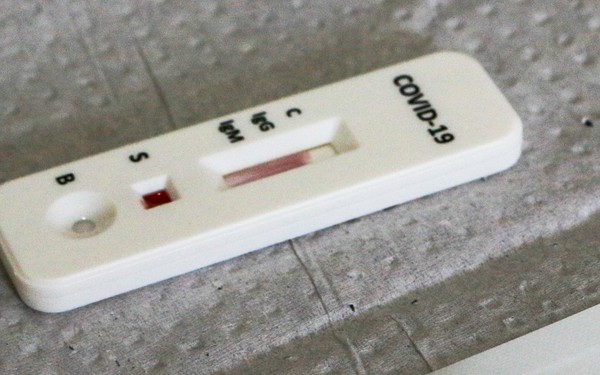 IgG e IgM positivo para Covid: entenda significado das siglas e diferença  entre teste rápido e PCR | Coronavírus | G1