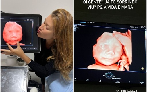 Gabriela Pugliesi mostra novo ultrassom do filho: "Grande e bochechudo"