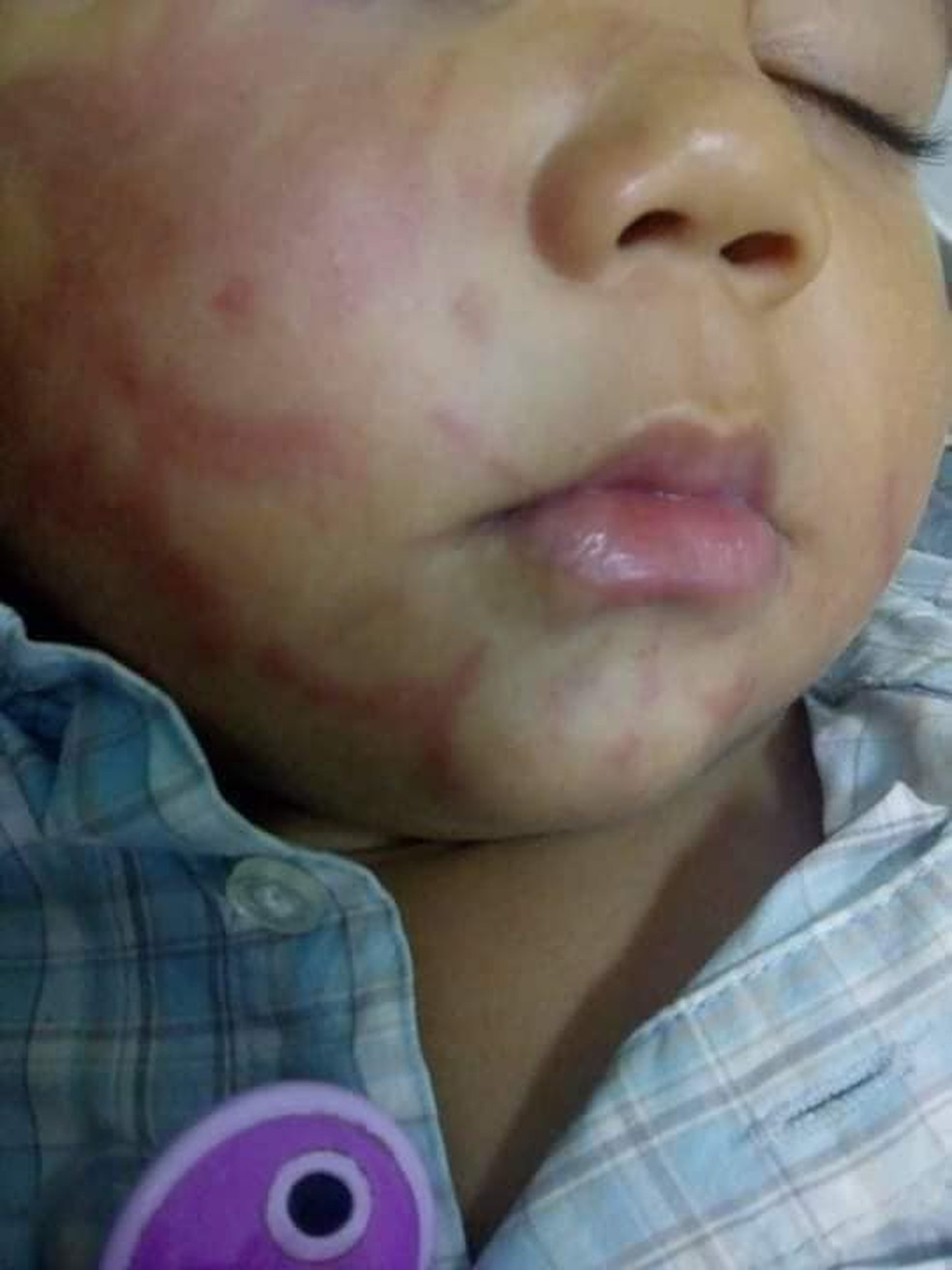 A mãe foi informada pela escola que o bebê estava engatinhando quando bateu o rosto no pé de uma mesa — Foto: Arquivo Pessoal