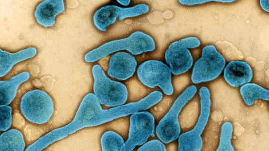 Gana confirma morte de criança pelo vírus de Marburg, primo do ebola