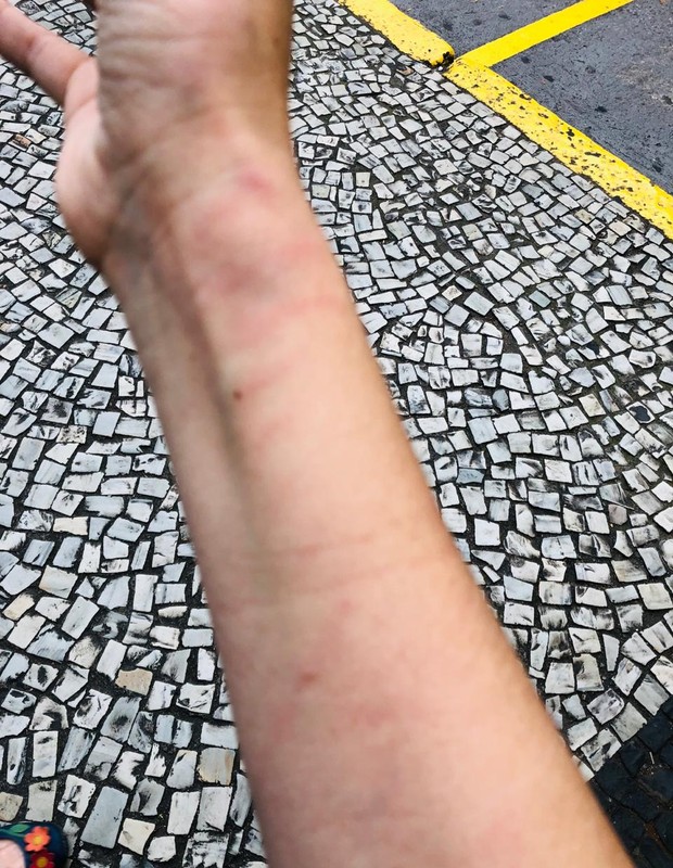 Cristiane Machado mostra agressões do ex-marido (Foto: Arquivo pessoal)