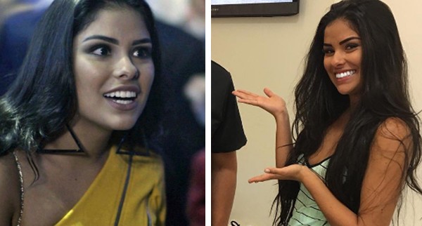 Munik Nunes antes e depois de clareamento de dentes (Foto: Reprodução / Instagram)