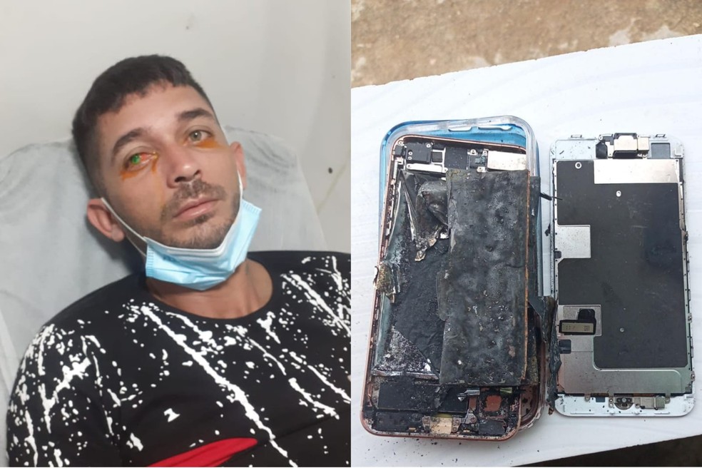 Agricultor pode perder olho direito após explosão de celular em Pedra Branca, no Ceará. — Foto: Arquivo pessoal