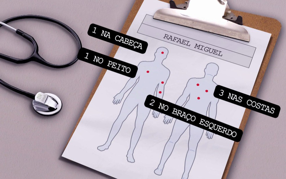 Laudo mostra onde o ator Rafael Miguel foi atingido — Foto: TV Globo/Reprodução