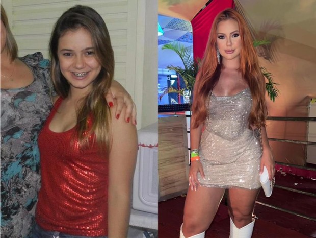Antes e depois de Mirela Janis (Foto: Reprodução/Instagram)