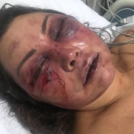 A paisagista Elaine Caparróz foi agredida por quatro horas dentro de seu apartamento, na Barra da Tijuca, na madrugada do dia 16 de fevereiro, durante seu primeiro encontro com o estudante de Direito Vinícius SerraArquivo pessoal