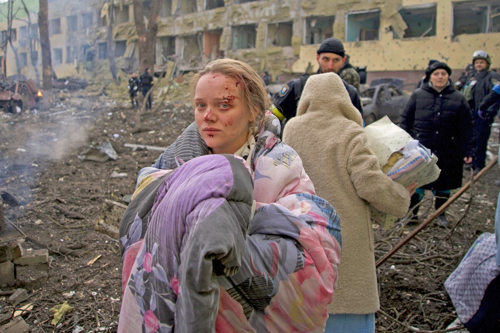 Mariana Vishegirskaya estava em maternidade bombardeada em março em Mariupol, no leste da Ucrânia, e foi levada para outro hospital — Foto: Mstyslav Chernov/AP Photo