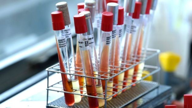 BBC - Nem todas as pessoas que correm o risco de ter se contagiado têm acesso aos exames de coronavírus nos EUA (Foto: Getty Images via BBC)