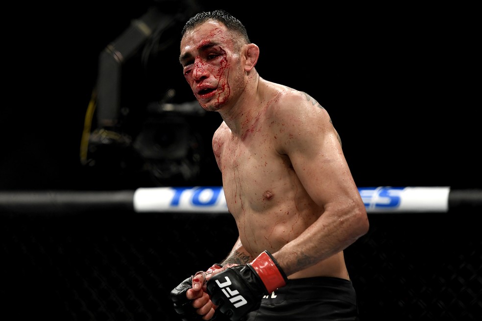 Tony Ferguson terminou a luta contra Justin Gaethje com o rosto muito ferido — Foto: Getty Images