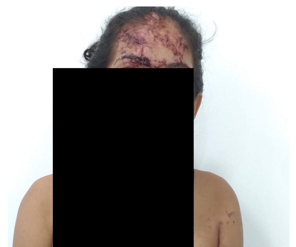 Adolescente teve ferimentos após acidente; namorado dela que dirigia carro fugiu em MS — Foto: Polícia Civil/Divulgação