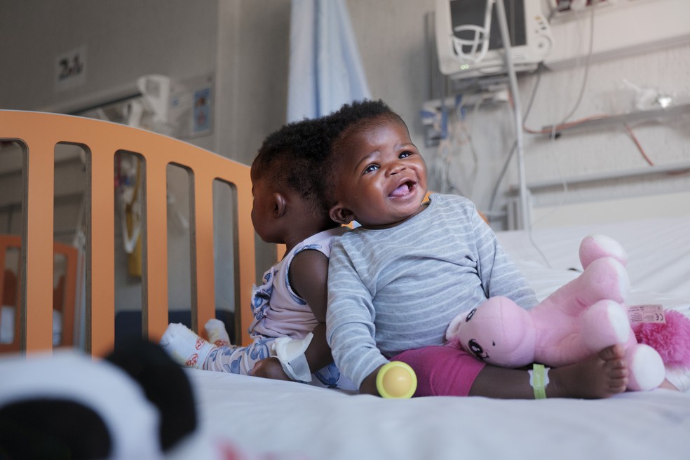 As irmãs gêmeas Ervina e Prefina, que nasceram unidas pela parte de trás da cabeça, são fotografadas antes de serem operadas no hospital em Roma, na Itália — Foto: Ospedale Pediatrico Bambino Gesu/Divulgação via Reuters