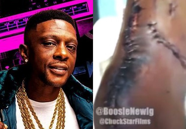 Rapper Boosie Badazz mostra cicatrizes após levar tiros (Foto: Reprodução/Instagram)
