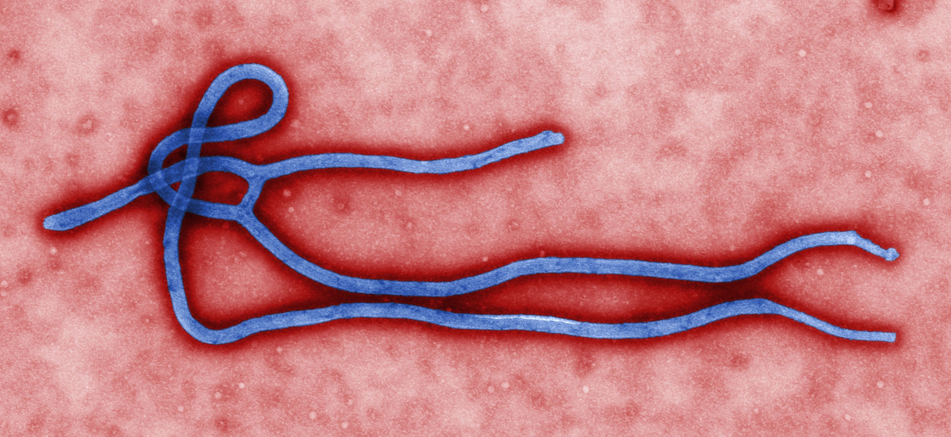 O virião do Ebola (Foto: wikimedia commons)