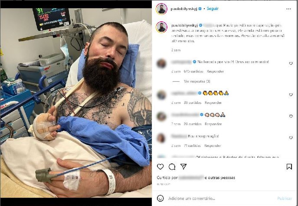 Delegado Paulo Bilynskyj foi operado para amputar o dedo médio da mão direita, que ficou comprometido após ter sido atingido por dois disparos feitos por sua namorada em 2020 — Foto: Reprodução/Arquivo pessoal/Instagram