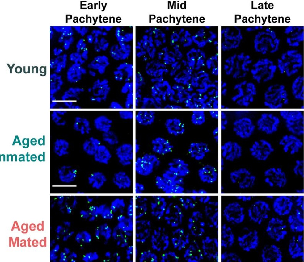 Imagens representativas dos focos RAD-51 em núcleos meióticos de linhagens germinativas jovens e envelhecidas de vermes  — Foto: E. Libuda et.al 