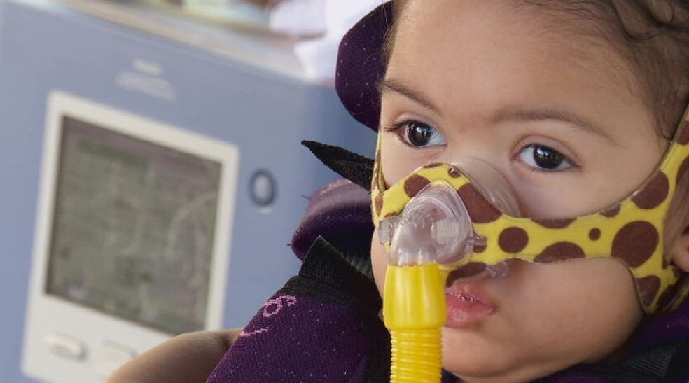 Marina Ciminelli, de um ano de nove meses, foi diagnosticada com AME, doença degenerativa rara — Foto: TV Globo/Reprodução