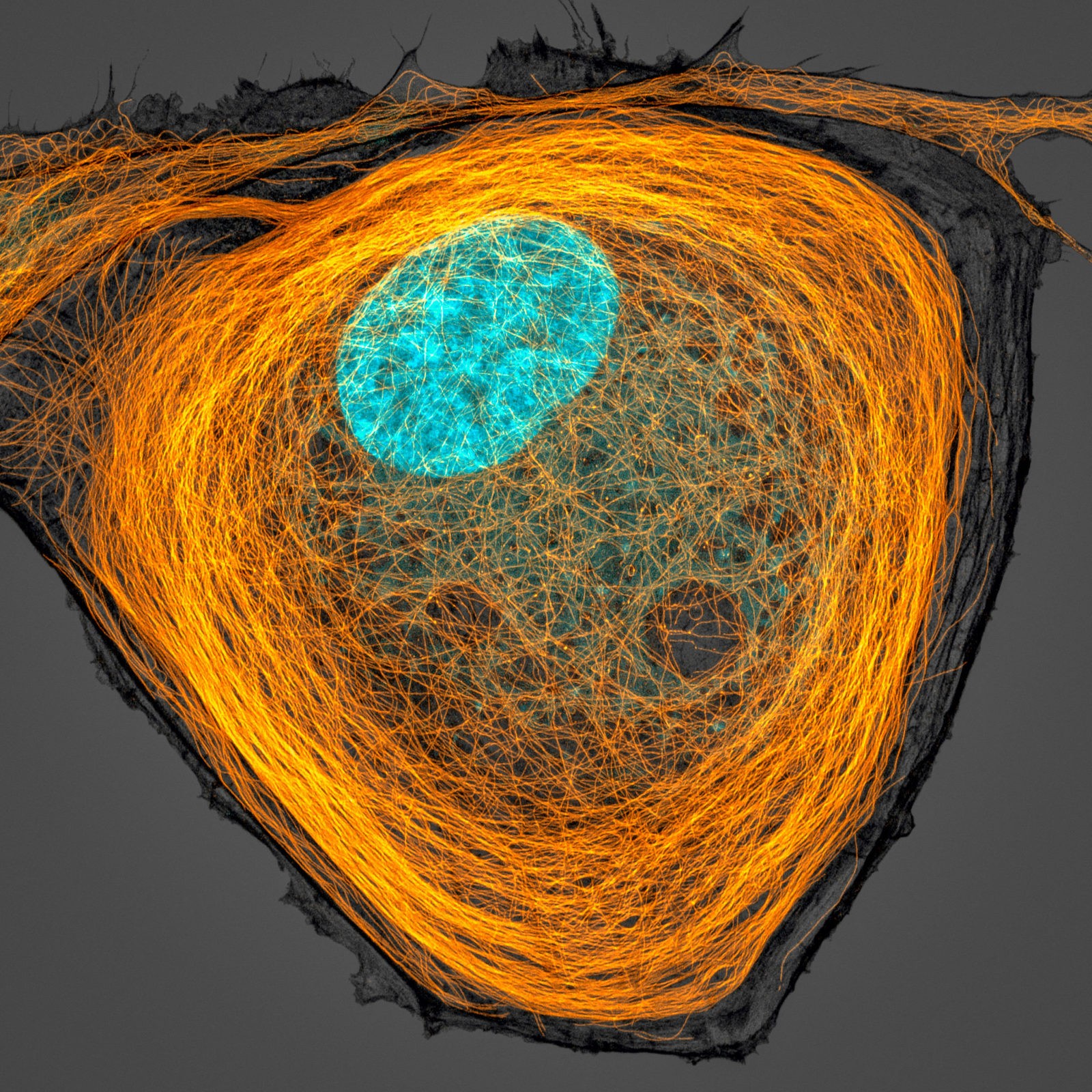 7 lugar: microtúbulos (laranja) dentro de uma célula. O núcleo é mostrado em ciano. (Foto: Jason Kirk/2020 Photomicrography Competition)