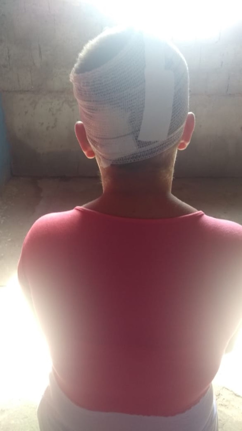 Dona de casa ainda se recupera da agressÃ£o que sofreu. Ela teve quase que a metade de todo o couro cabeludo arrancado Ã  faca â€” Foto: Ediana Miralha/Inter TV Cabugi 