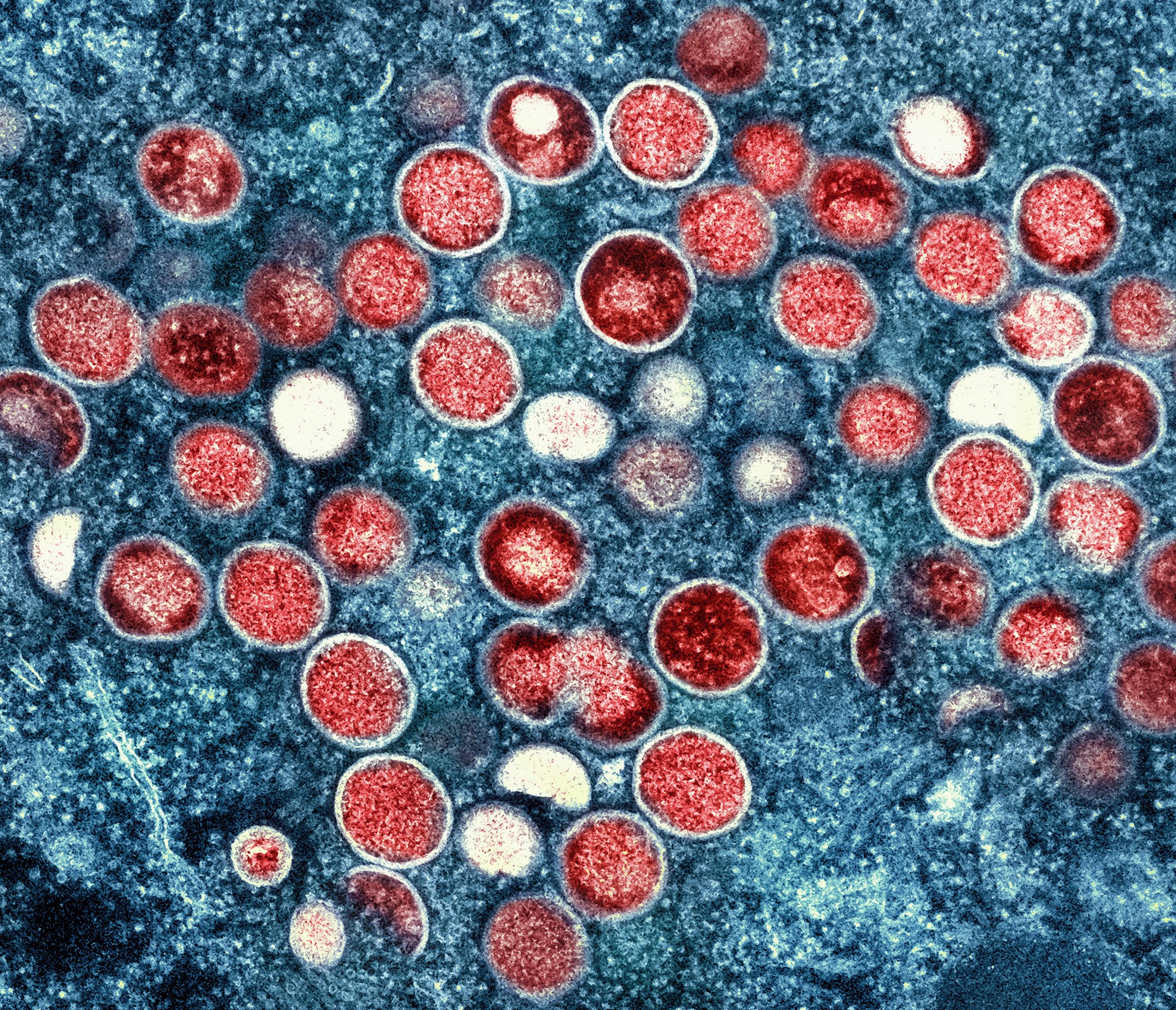 Imagem colorida mostra partículas de varíola de macaco (vermelho) encontradas dentro de uma célula infectada (azul), cultivadas em laboratório (Foto: NIAID/Divulgação)