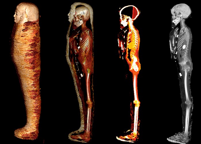 Tomografias revelam 49 amuletos preciosos em múmia de 2,3 mil anos — Foto: Divulgação/SN Saleem, SA Seddik, M el-Halwagy