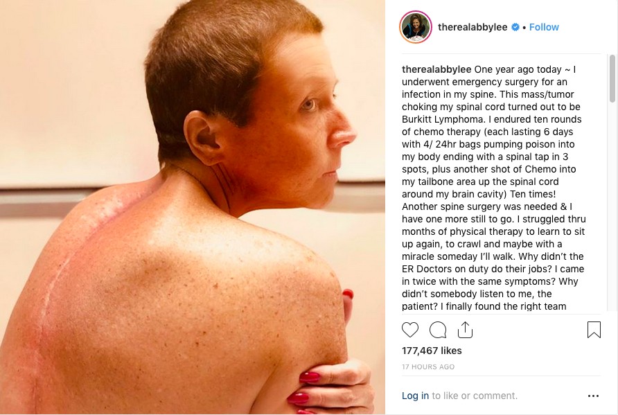 O post de Abby Lee Miller falando sobre sua luta contra um câncer e criticando os diagnósticos de seus médicos (Foto: Instagram)