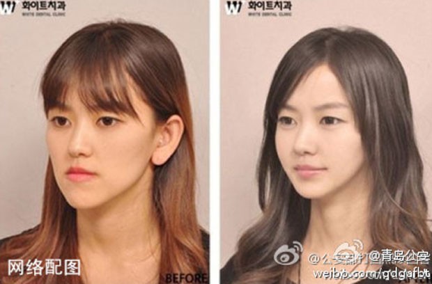 Para provarem identidade, pacientes que buscam cirurgia plástica na Coreia do Sul recebem 'documento' atestando que fizeram procedimento estético no país (Foto:  Reprodução/Weibo/Qingdao)