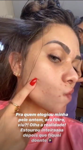 Flavia Pavanelli mostra batalha contra acne na web (Foto: Reprodução/Instagram)