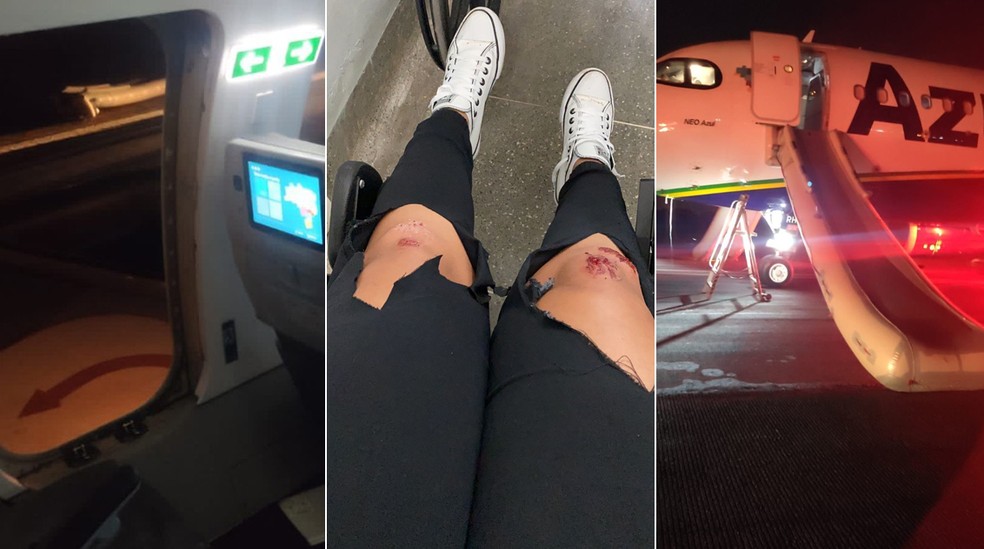 Montagem mostra imagem no interior de avião, passageira com joelho machucado e avião após pouso — Foto: reprodução e divulgação