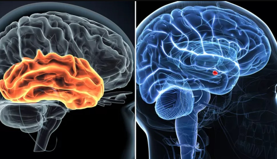 Os estudos indicaram uma interação entre o córtex auditivo (esquerda) e a amígdala (direita) (Foto: GETTY IMAGES (via BBC))
