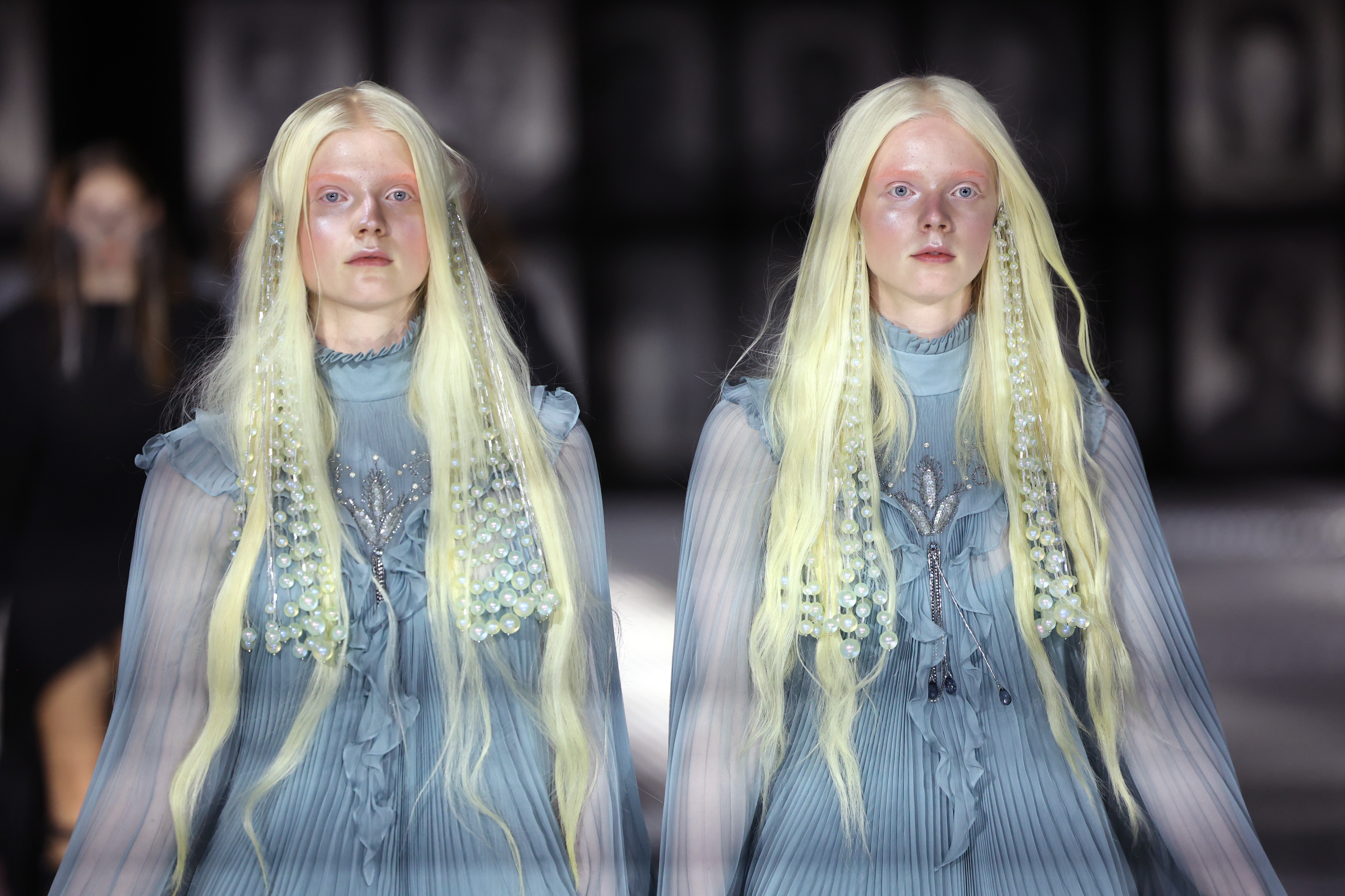 Jenny Miranda mostra antes e depois e harmonização facial feita