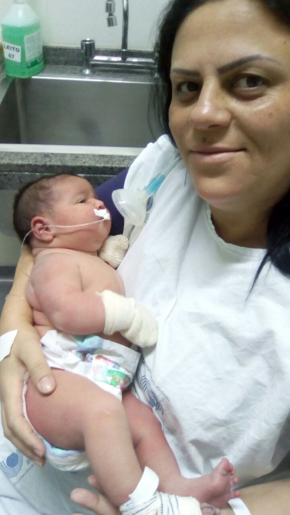 Bebe Que Nasceu Com Quase 6 Quilos E Caso Raro Diz Pediatra Oeste E Sudoeste G1