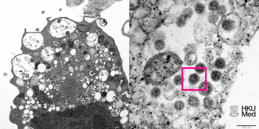 Imagem destaca variante ômicron do coronavírus feita com um microscópio — Foto: Cortesia Faculdade de Medicina da Universidade de Hong Kong