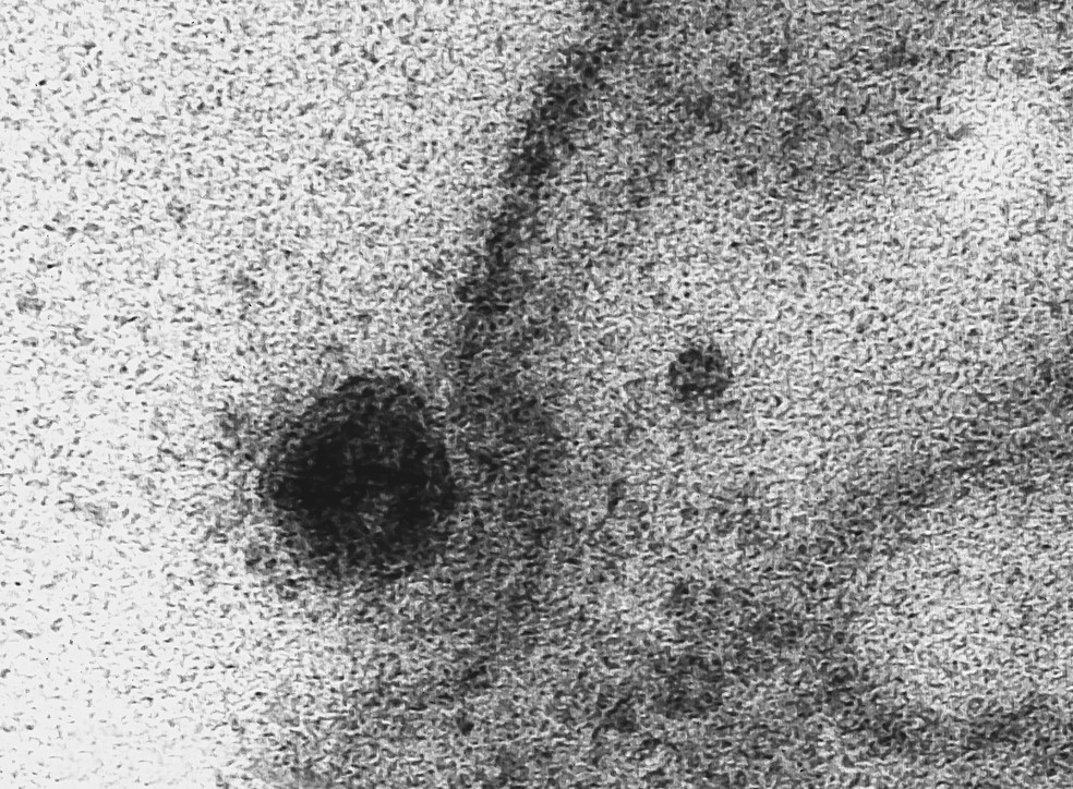 Imagem de microscopia mostra à esquerda o Sars-Cov-2, o novo coronavírus, atacando a membrana de uma célula. Esfera escura à esquerda — Foto: IOC/Fiocruz