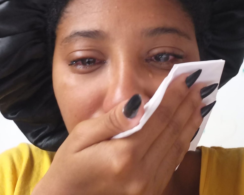 Mulher tem hemorragia no olho após usar pomada de cabelo em penteado — Foto: g1/Arquivo pessoal