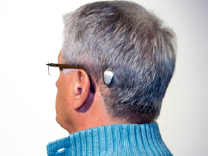 Implante auditivo Baha (Foto: Arquivo/ Cochlear)