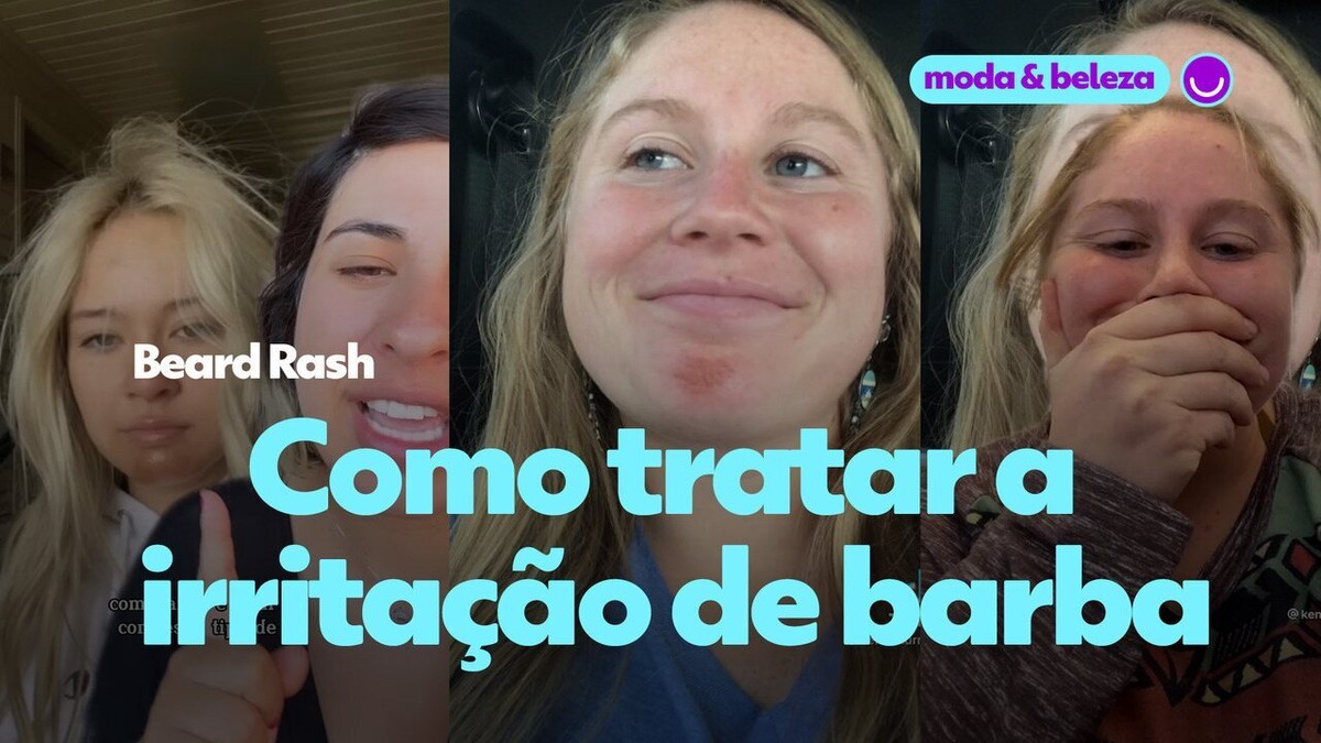 Beard rash saiba o que é e como tratar a irritação de barba Moda