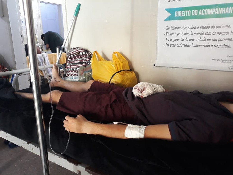 Wellington Araújo, de 19 anos, sofreu fraturas na mão direita e foi internado no Hospital Dirceu Arcoverde, em Parnaíba (PI) — Foto: Arquivo Pessoal/ Antônio Araújo